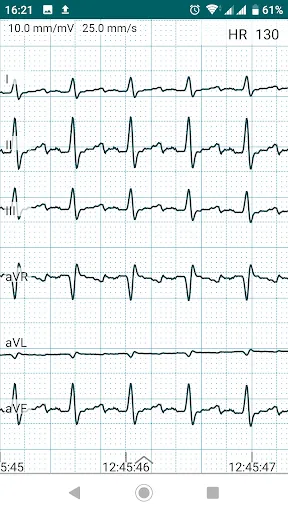 ภาพหน้าจอของ DiaCard - ECG Recorder