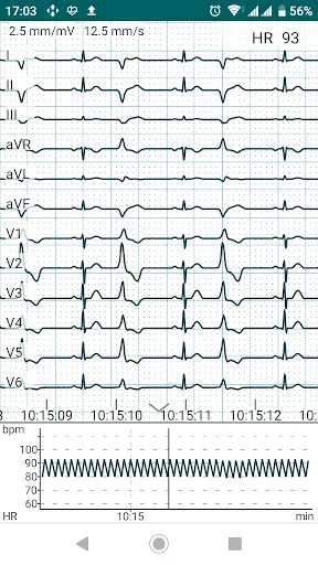 ภาพหน้าจอของ DiaCard - ECG Recorder