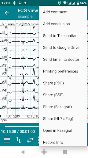 ภาพหน้าจอของ DiaCard - ECG Recorder