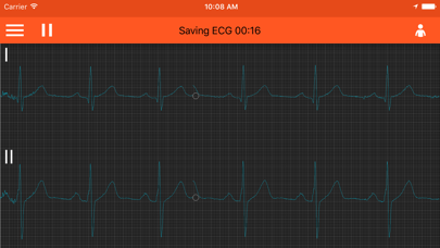 صور Spaulding ECG