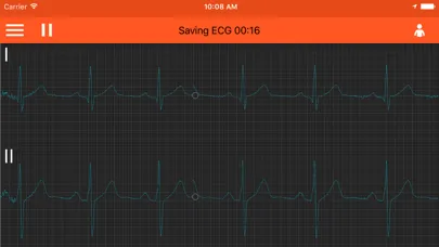 Tangkapan skrin Spaulding ECG