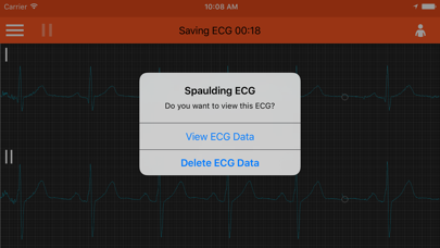 صور Spaulding ECG