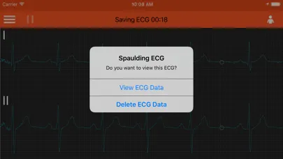 Tangkapan skrin Spaulding ECG