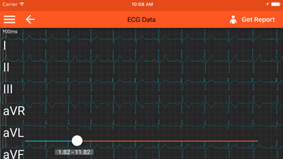صور Spaulding ECG