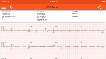 صور Spaulding ECG