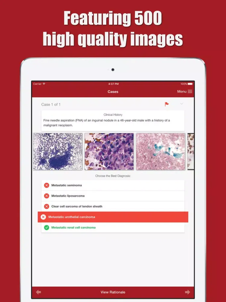 ภาพหน้าจอของ Cytopathology Case Review Atlas iPad 