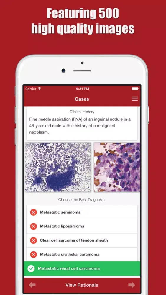 ภาพหน้าจอของ Cytopathology Case Review Atlas