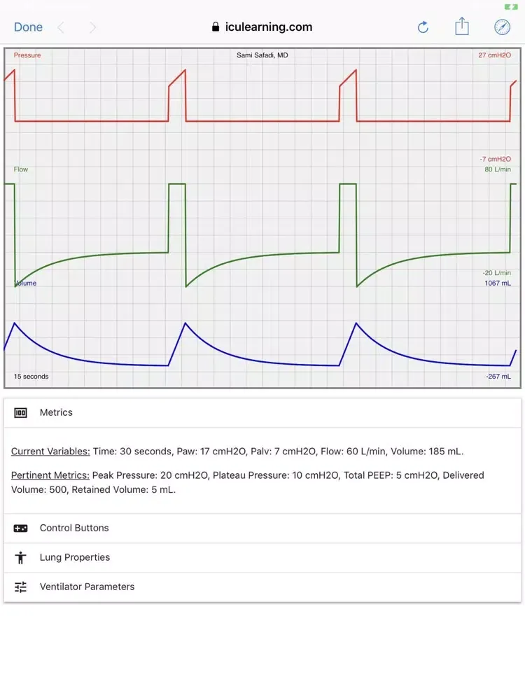 Ventilator Simulator iPad  Screenshots