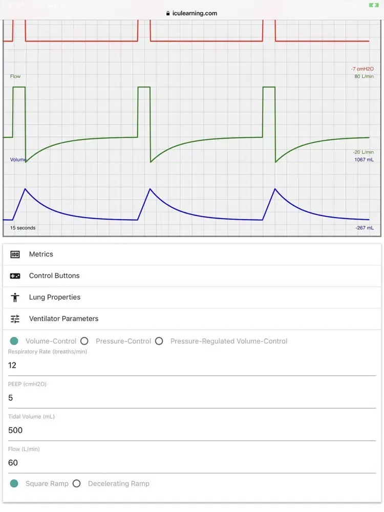 Ventilator Simulator iPad  Screenshots