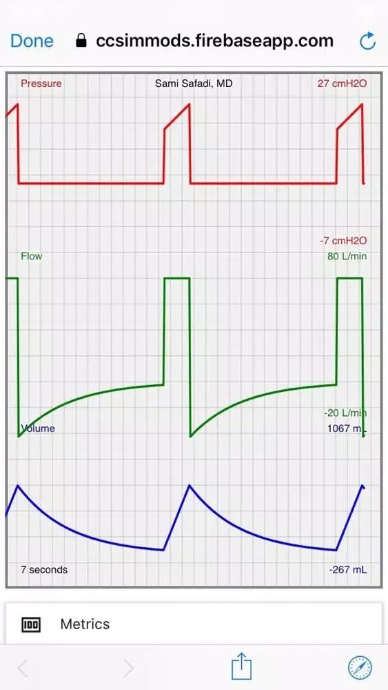 Ventilator Simulator Screenshots