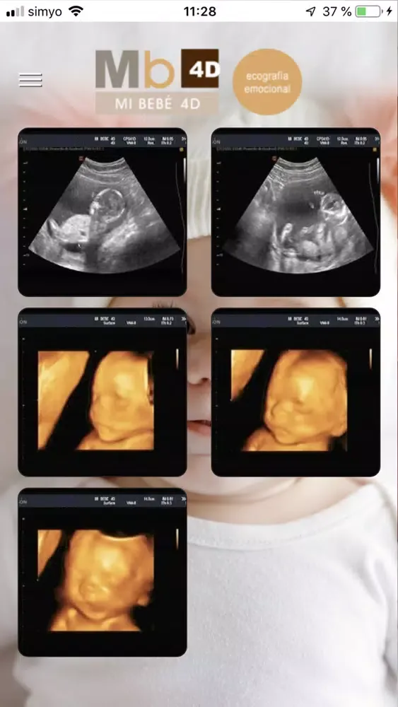 Capturas de tela do MiBebe4D