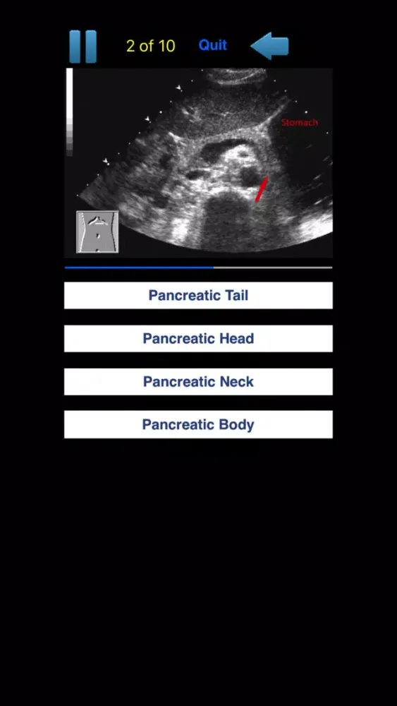Zrzuty ekranu Sono Quiz Abdominal