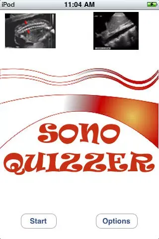 Sono Quiz Lite سکرین شاٹس