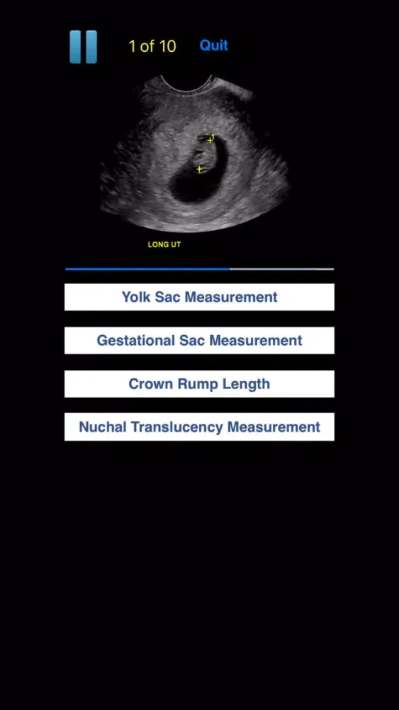 تصاویر Sono Quiz OB-GYN