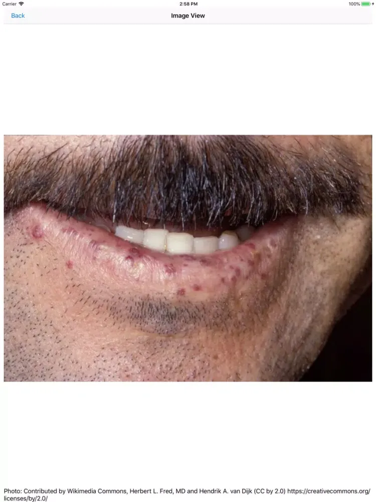 Tangkapan skrin Dermatology Reviews iPad 