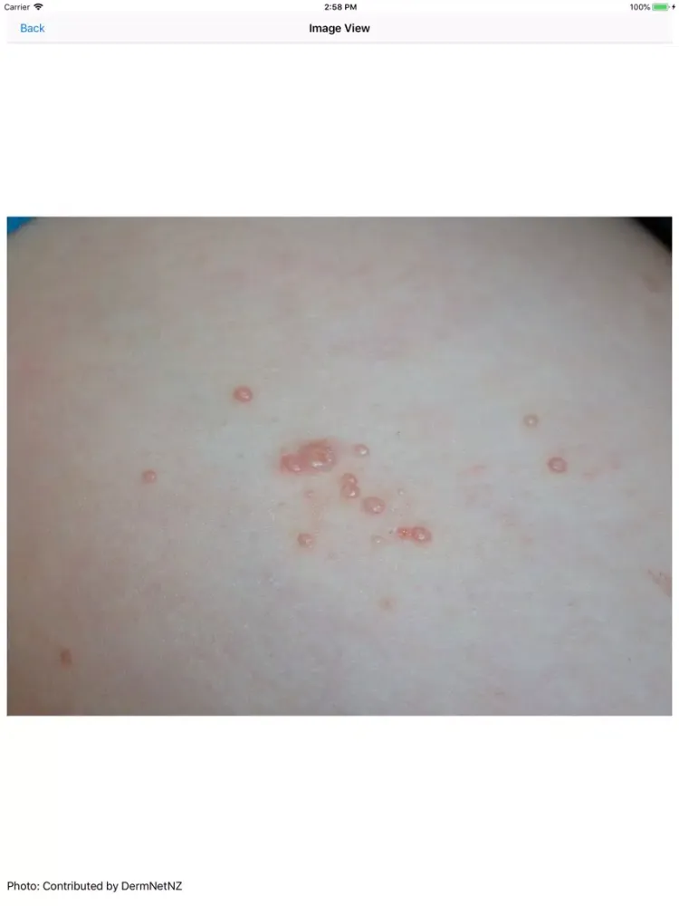 Tangkapan skrin Dermatology Reviews iPad 