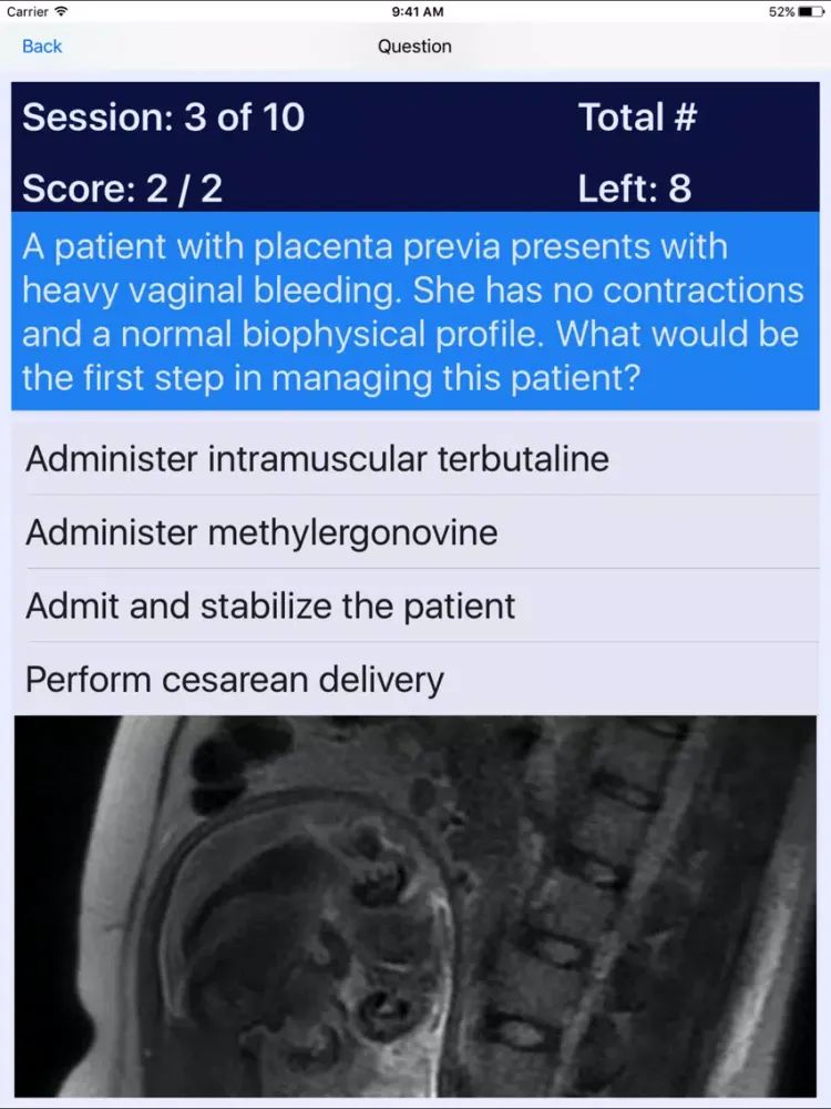 Maternal Newborn Nurse MNN Review iPad  Screenshots
