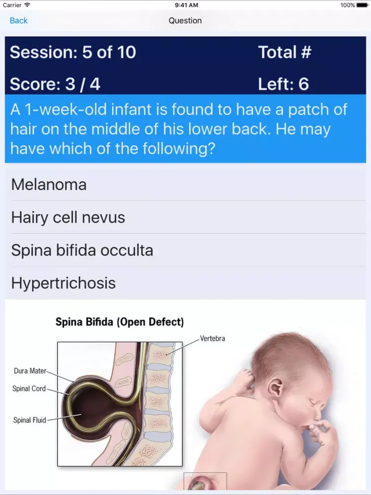 Captures d'écran de NP Neonatal Review iPad 