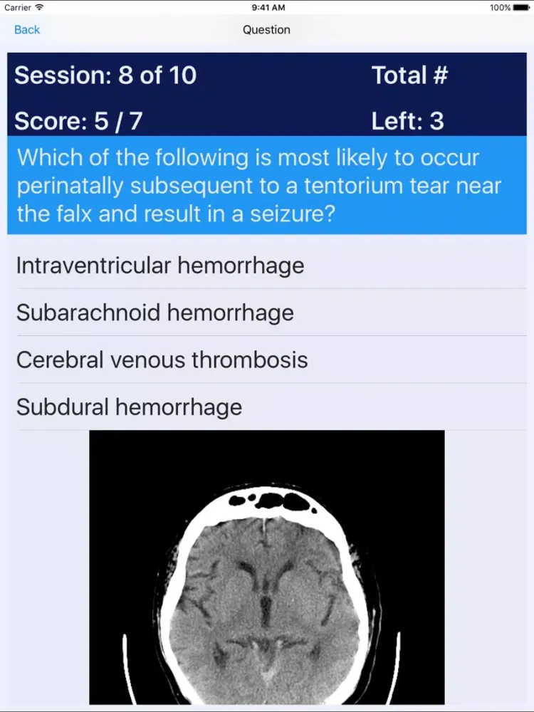 Captures d'écran de NP Neonatal Review iPad 