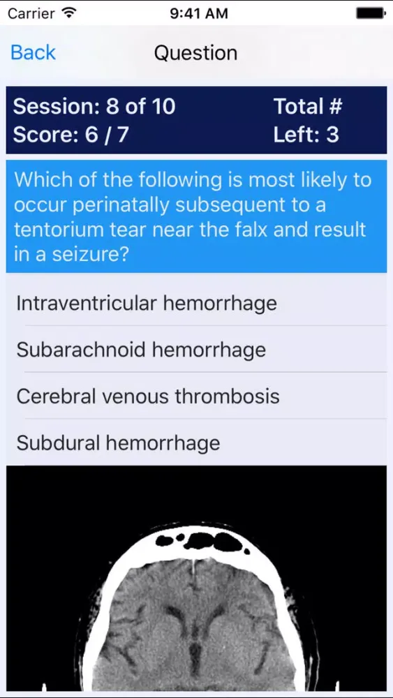 Captures d'écran de NP Neonatal Review