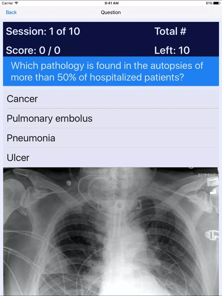 Oncology Board Review iPad  स्क्रीनशॉट