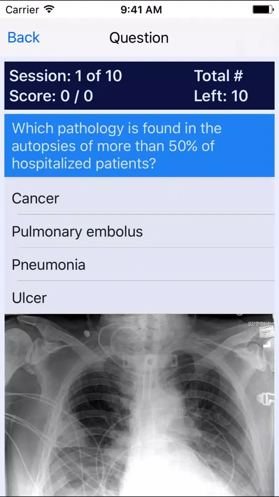 Oncology Board Review स्क्रीनशॉट
