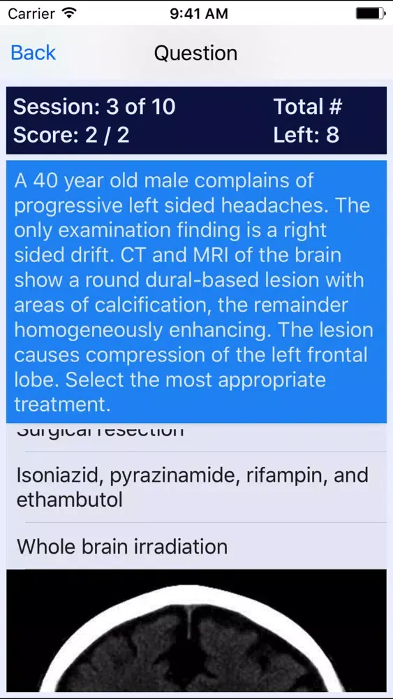 Oncology Board Review स्क्रीनशॉट