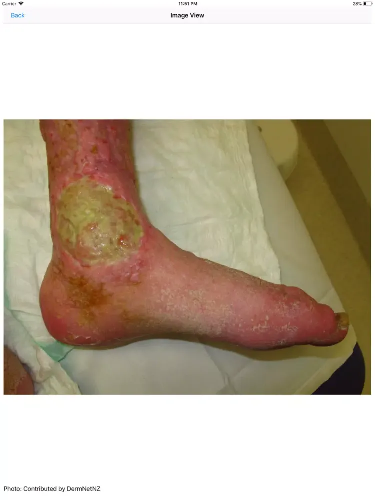 Wound Care Nursing iPad  سکرین شاٹس