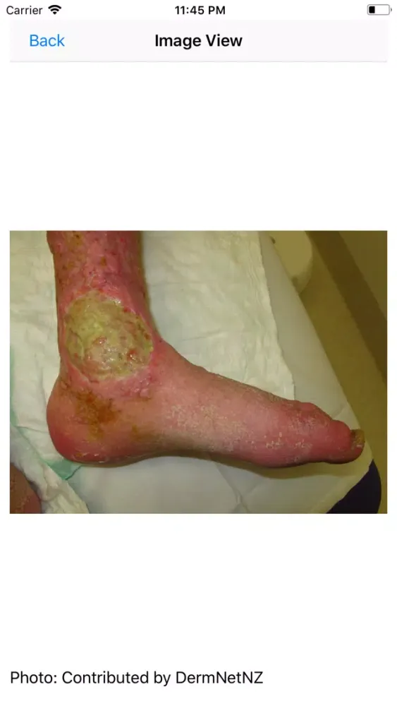 Wound Care Nursing سکرین شاٹس
