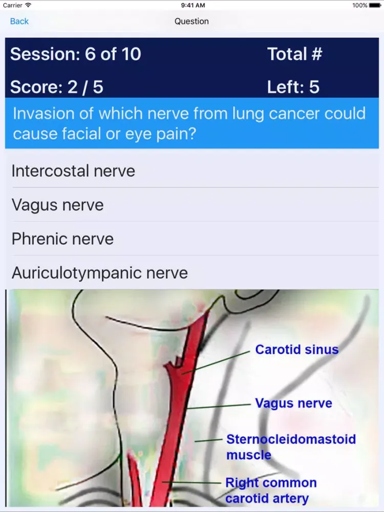 Tangkapan skrin Oncology Nursing (OCN) Review iPad 