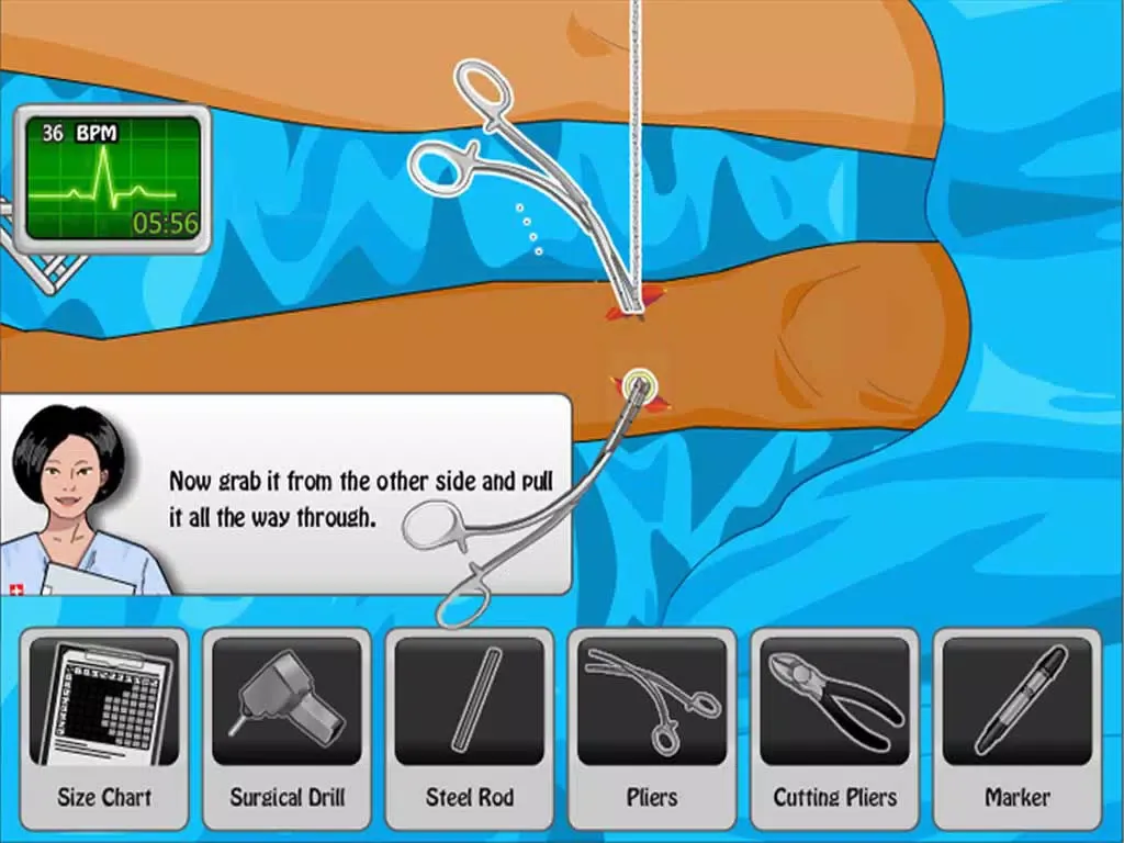 Screenshot di Knee Surgery HD iPad 