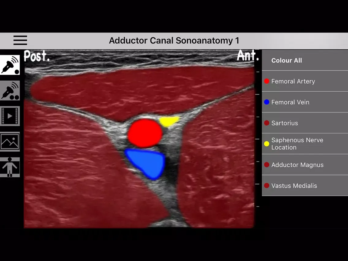 Ảnh chụp màn hình của AnSo Anaesthesia Sonoanatomy iPad 