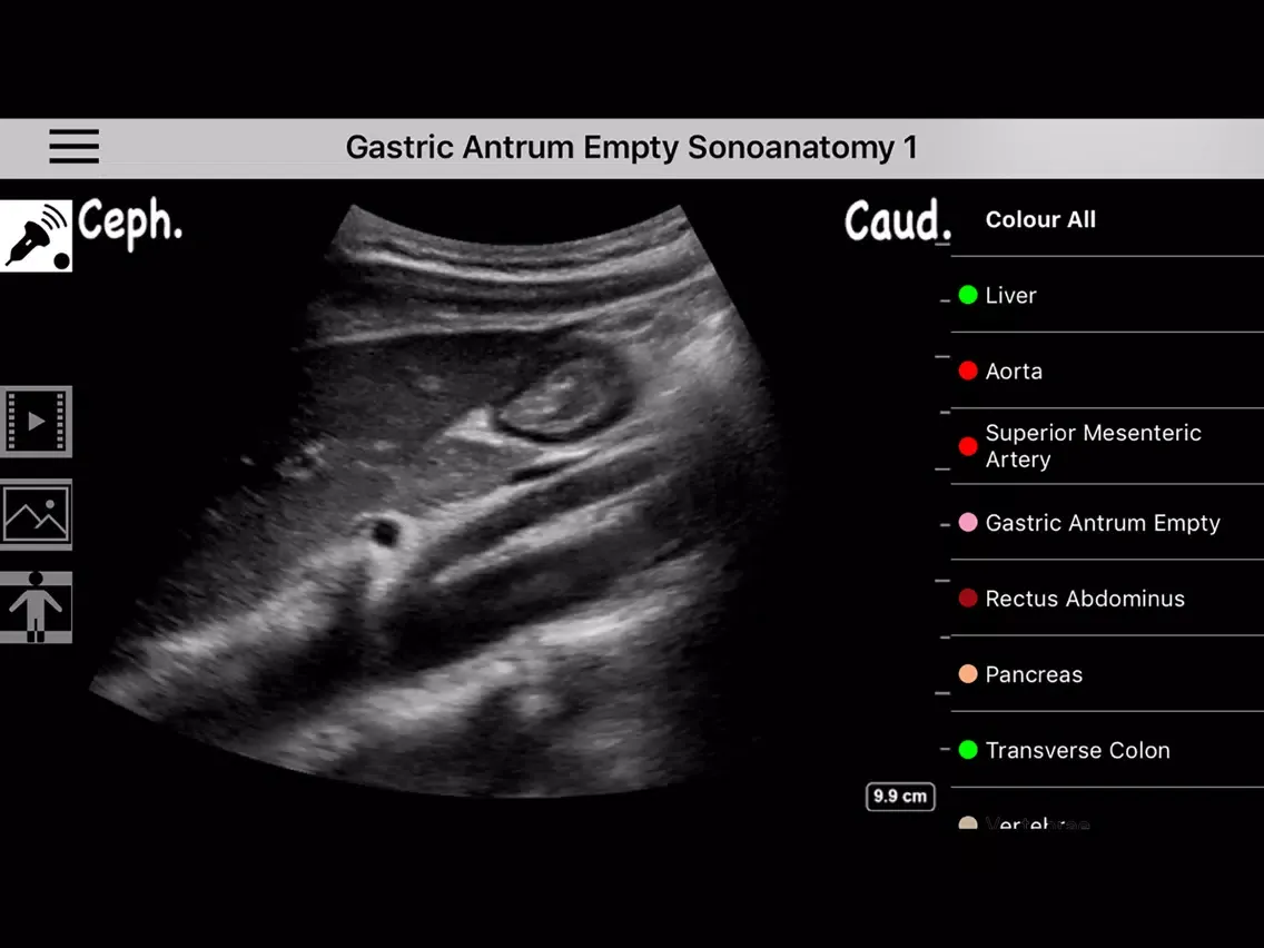 Ảnh chụp màn hình của AnSo Anaesthesia Sonoanatomy iPad 