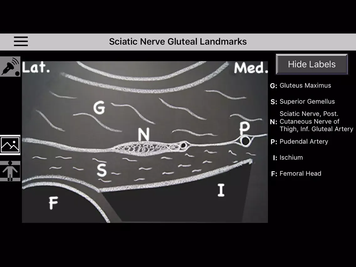 Ảnh chụp màn hình của AnSo Anaesthesia Sonoanatomy iPad 