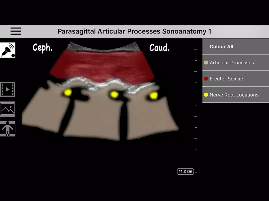 Ảnh chụp màn hình của AnSo Anaesthesia Sonoanatomy iPad 