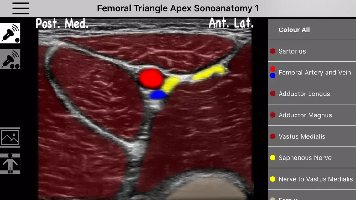 Ảnh chụp màn hình của AnSo Anaesthesia Sonoanatomy