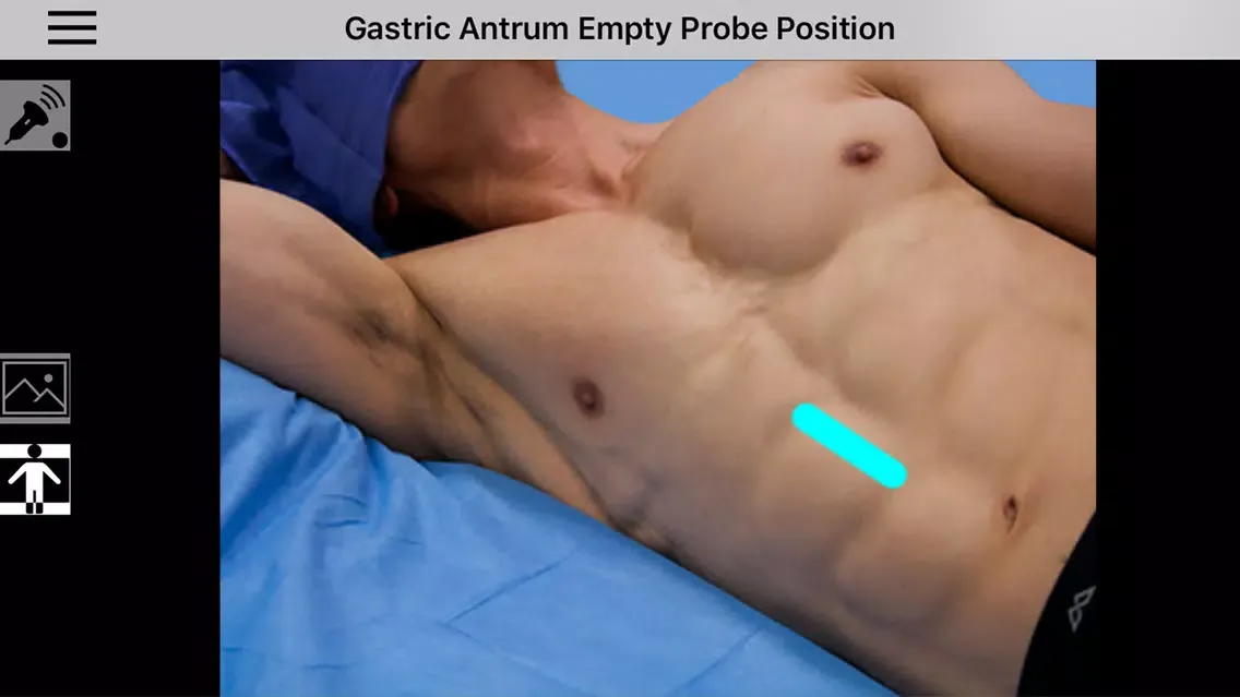 Ảnh chụp màn hình của AnSo Anaesthesia Sonoanatomy