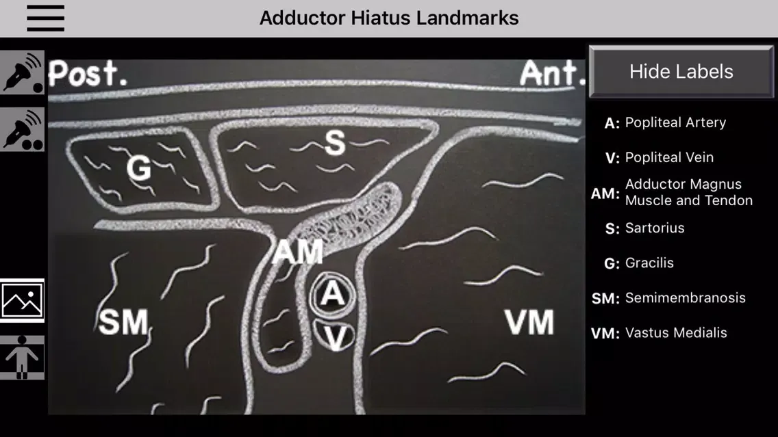 Ảnh chụp màn hình của AnSo Anaesthesia Sonoanatomy