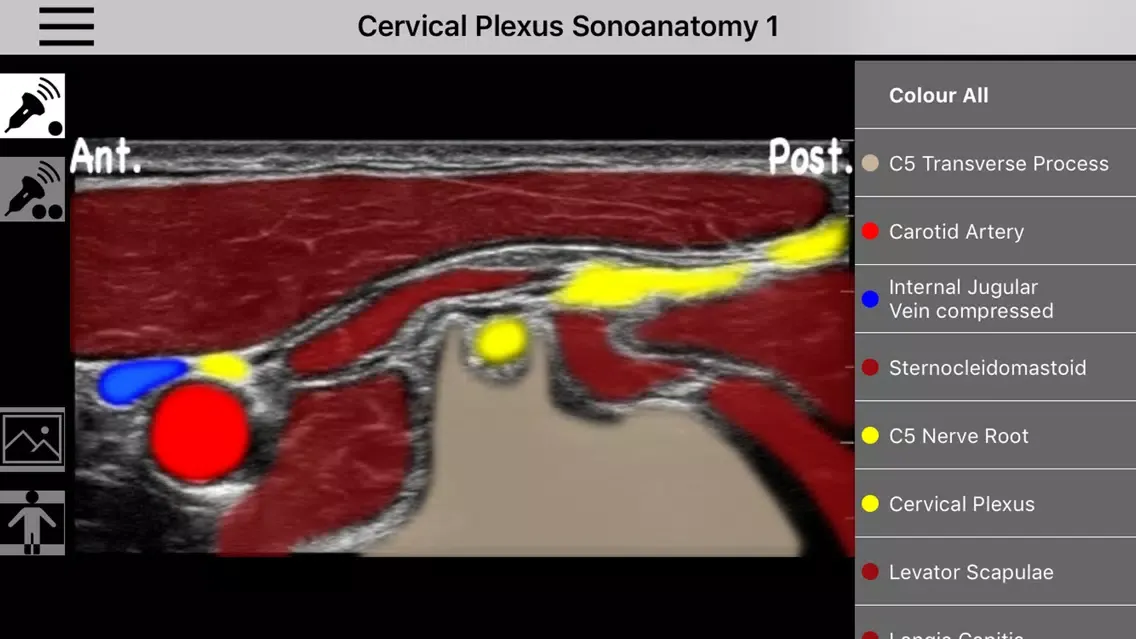 Ảnh chụp màn hình của AnSo Anaesthesia Sonoanatomy