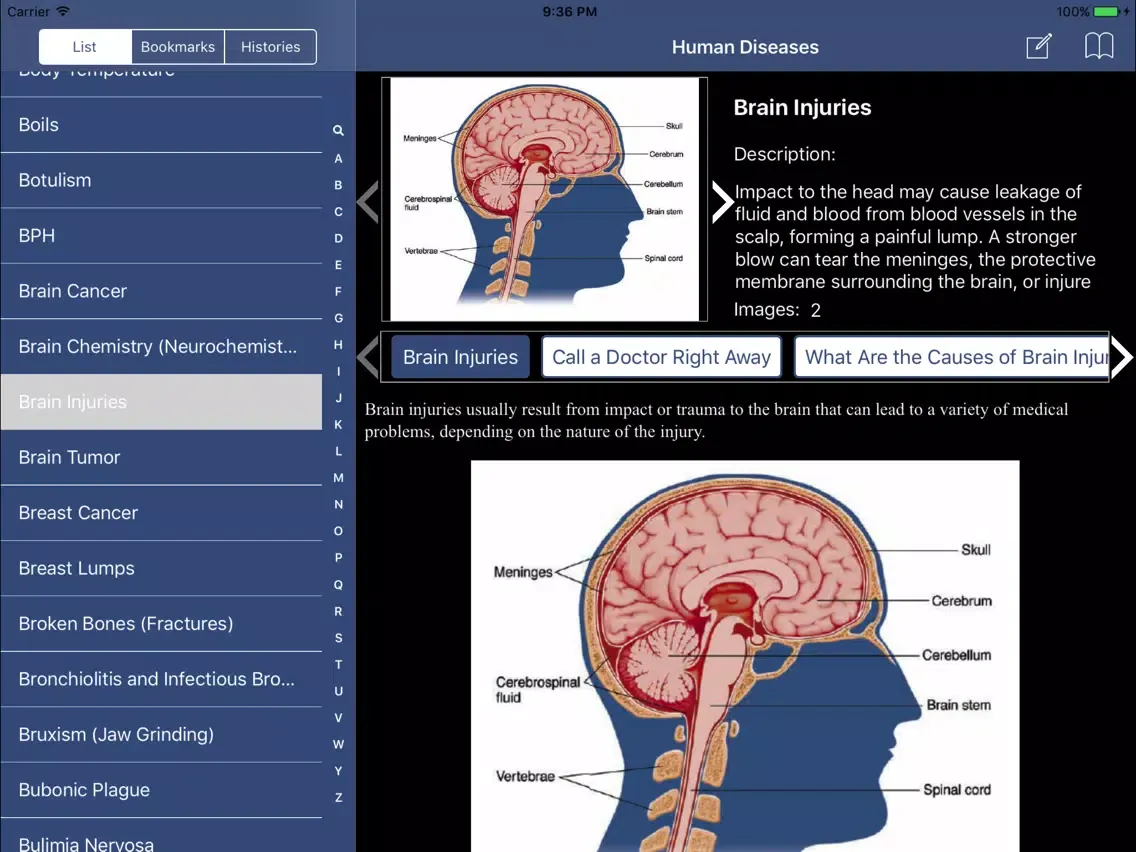 Tangkapan layar Encyclopedia of Human Diseases iPad 