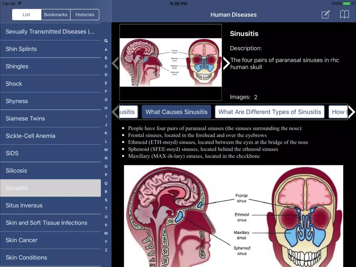 Tangkapan layar Encyclopedia of Human Diseases iPad 
