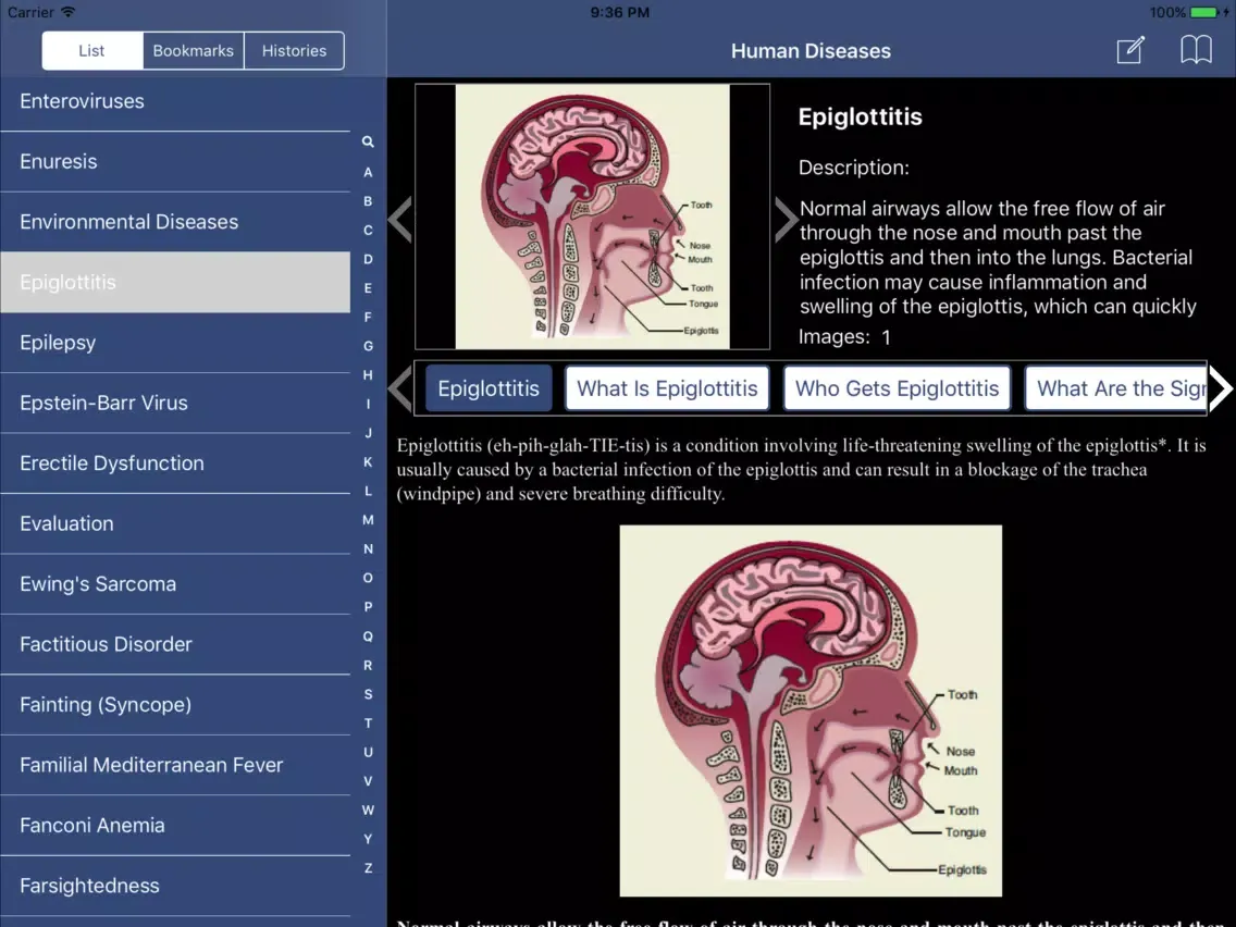 Tangkapan layar Encyclopedia of Human Diseases iPad 