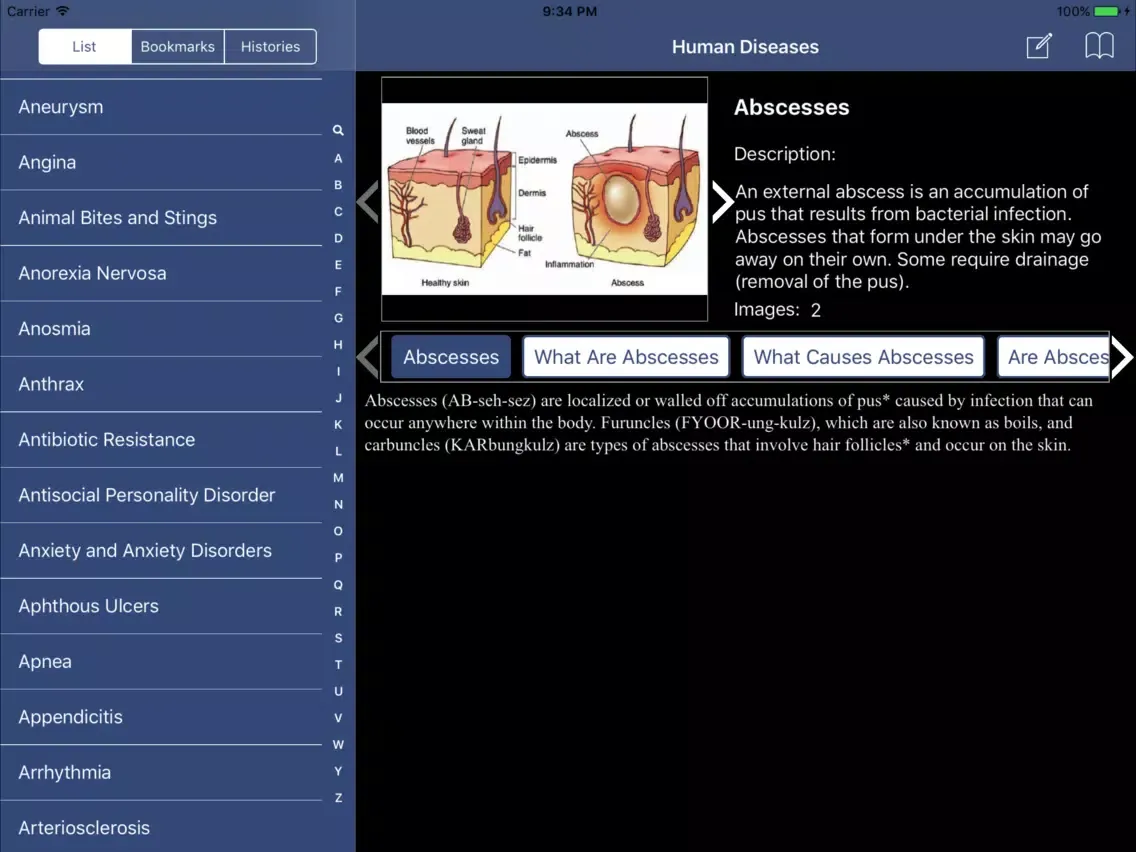 Tangkapan layar Encyclopedia of Human Diseases iPad 