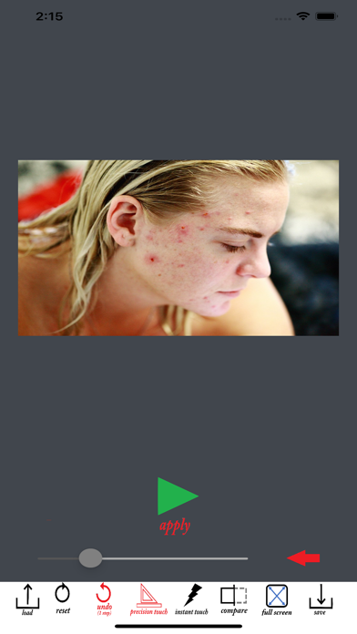 Wrinkle Remover Blemish Editor 스크린샷