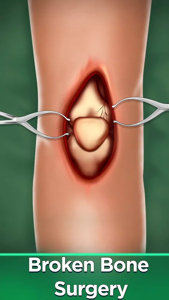 Surgery Simulator Doctor Games Screenshots