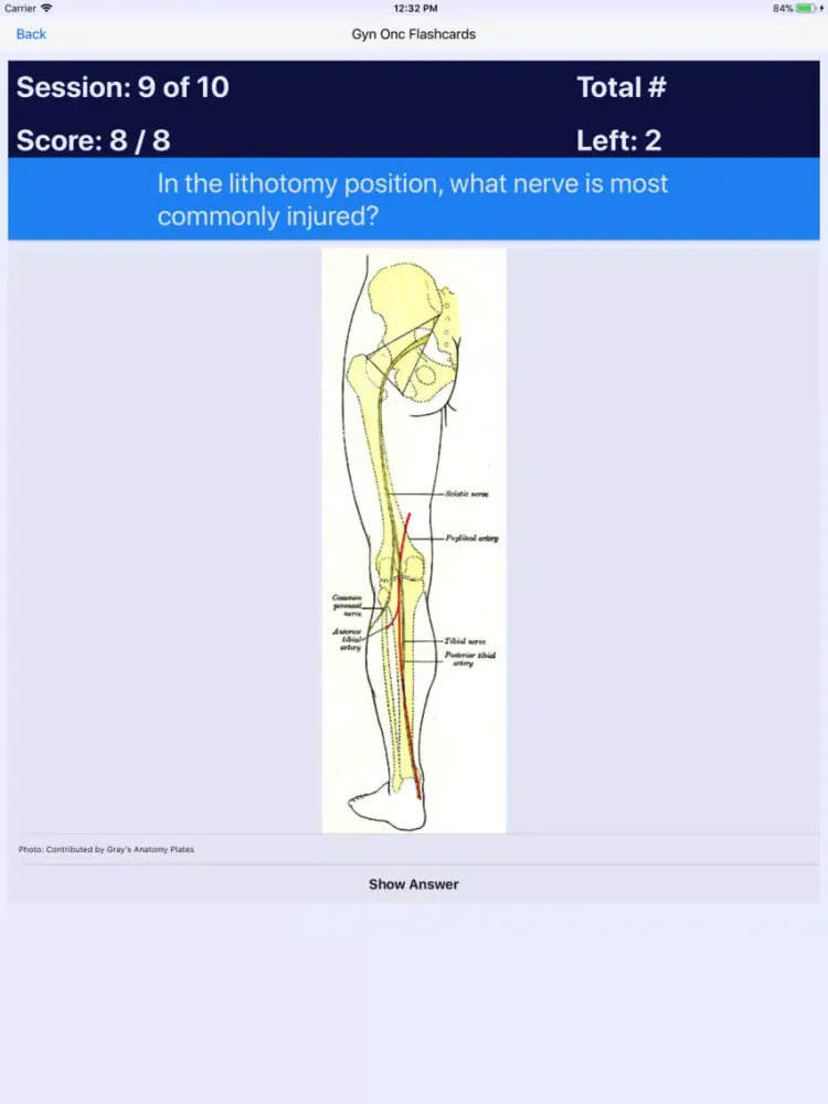 GYN ONC Board Review iPad 應用截圖