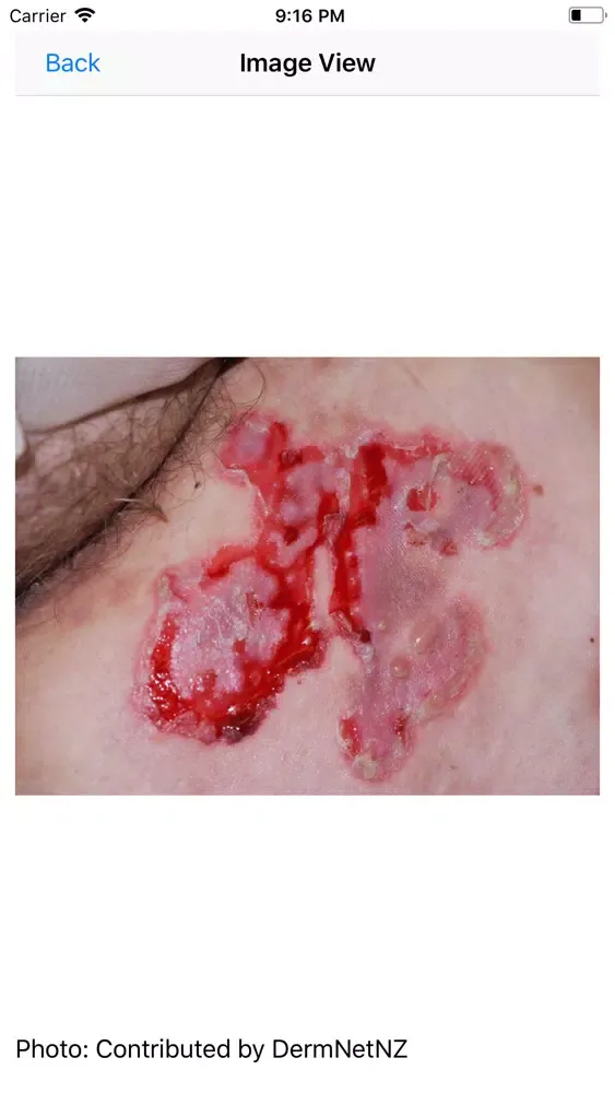 Podiatry (APMLE) Review应用截图