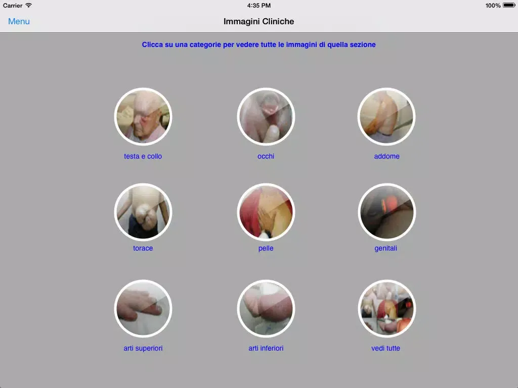 Capturas de tela do Enciclopedia MEDICA illustrata LITE iPad 