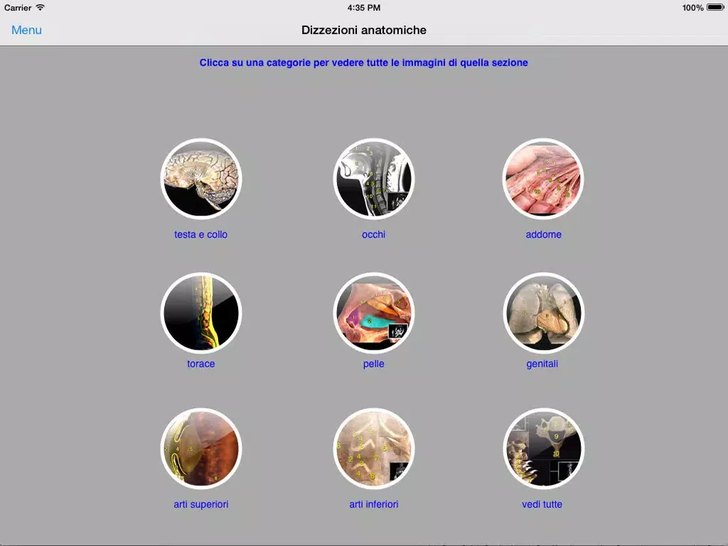 Capturas de tela do Enciclopedia MEDICA illustrata LITE iPad 