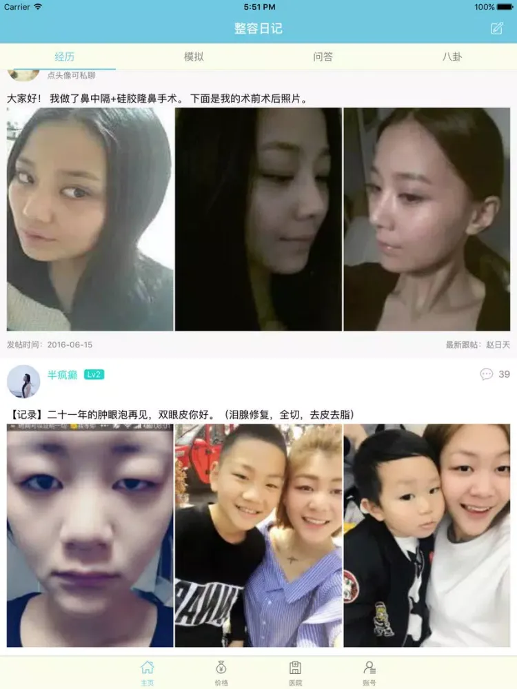 整容日记-新养颜整容对比图，氧气女孩双眼皮隆鼻瘦脸吸脂丰胸美容日记 iPad  Screenshots